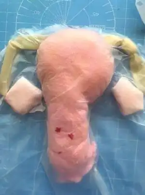 Ectopic Simulation